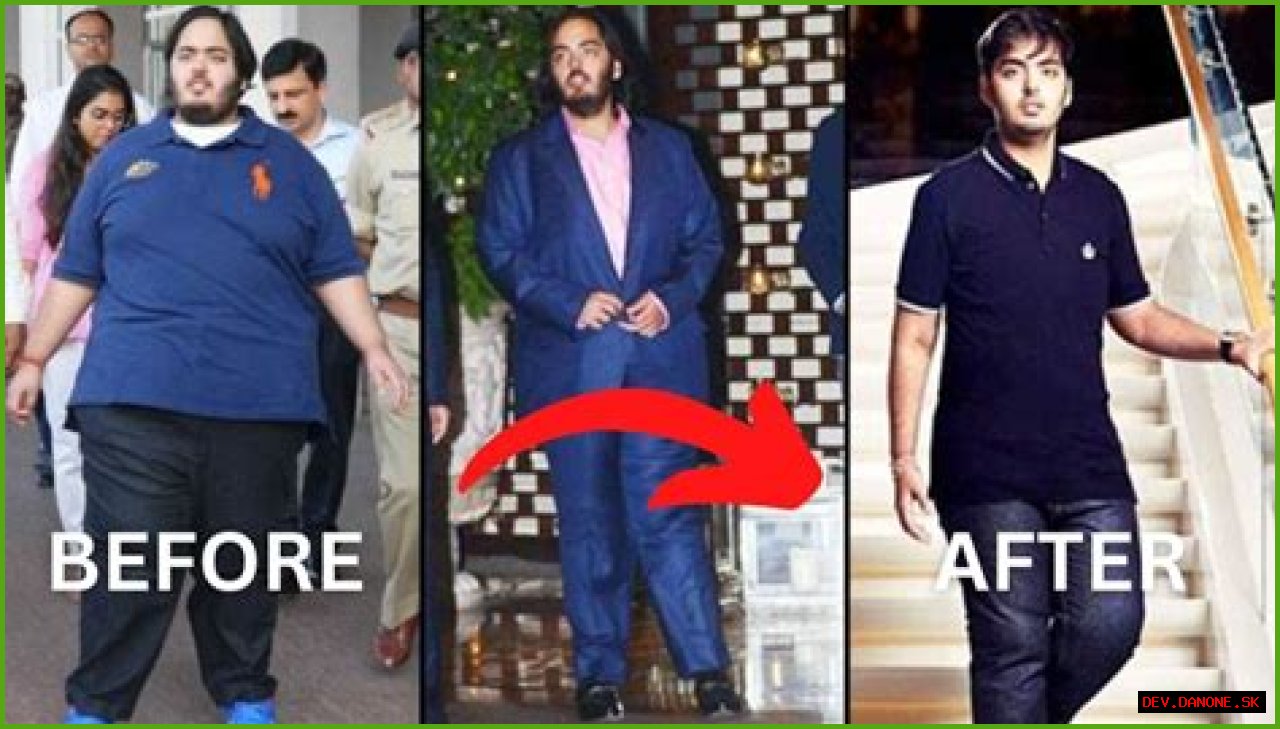 Anant Ambani's Health Condition: A Deep Dive Into His Journey