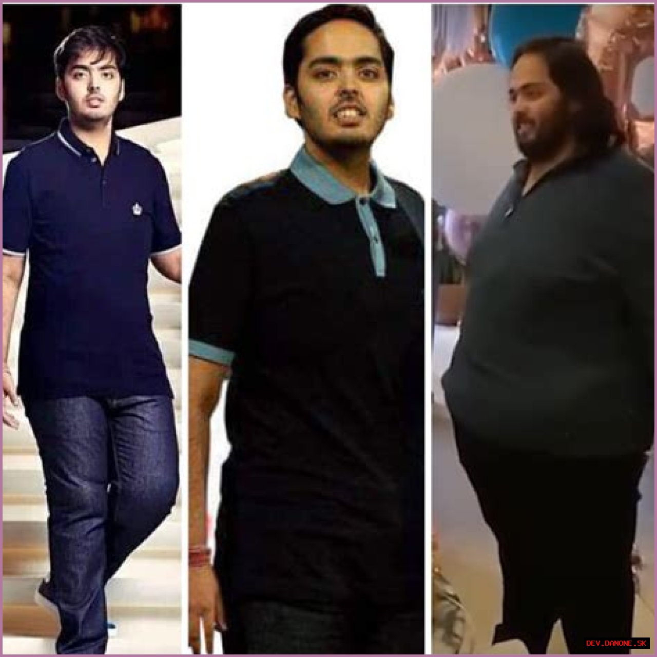 Anant Ambani's Journey: Understanding His Health Challenges