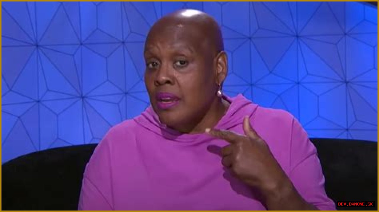 Felicia Of Big Brother Opens Up About Hair Loss Journey