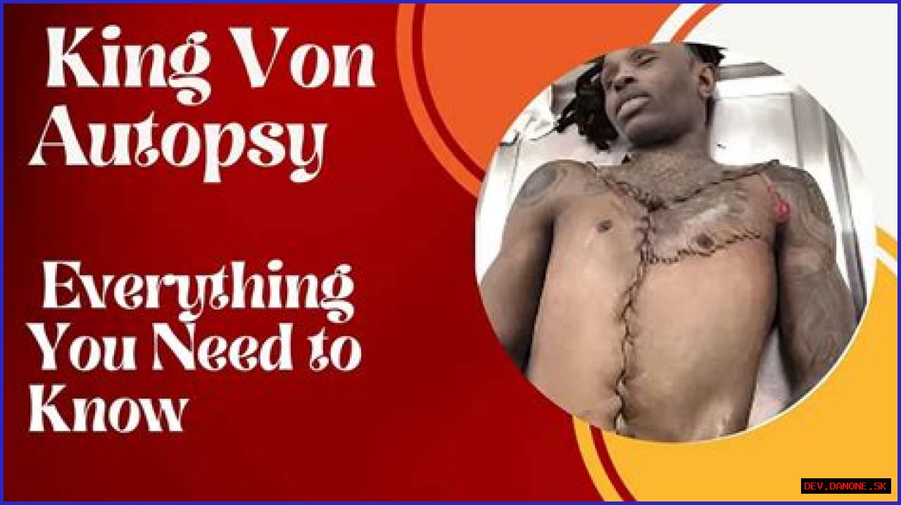 The Autopsy Of King Von: An In-Depth Investigation