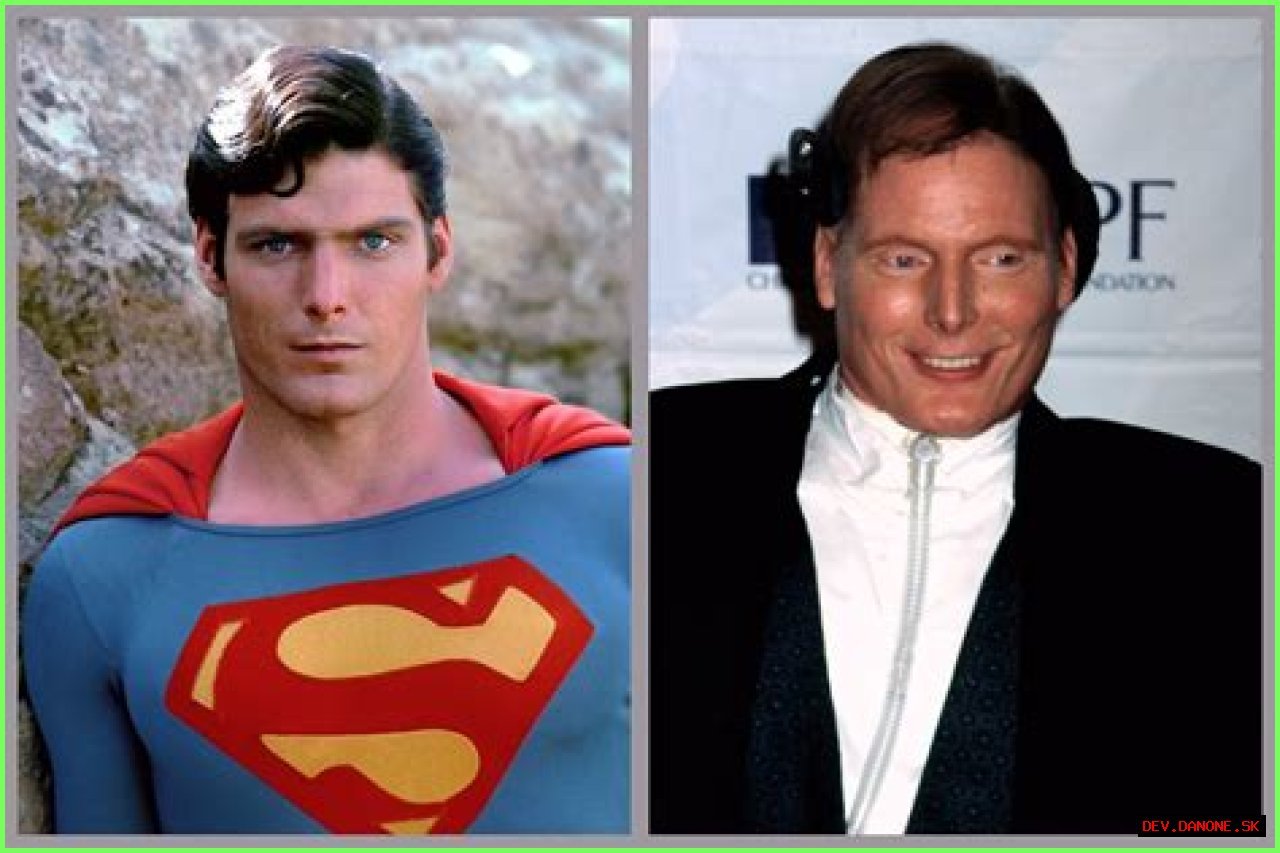 Understanding The Age Of Christopher Reeve At His Passing