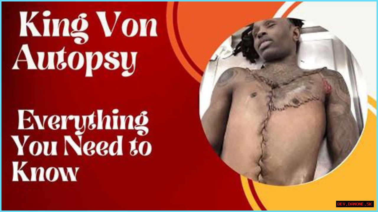 Unraveling The Mystery: King Von Body Autopsy